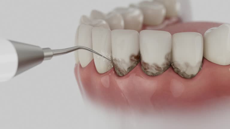 Reliable Dental contractor in Peru, IN by Dentist Open Now